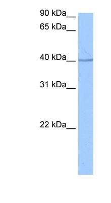 Western Blot: SP6 Antibody [NBP1-79438]