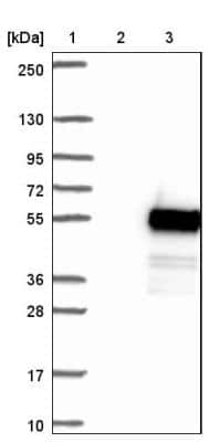 Western Blot: SP6 Antibody [NBP1-92428]