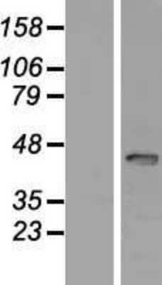 Western Blot: SP6 Overexpression Lysate [NBP2-04622]