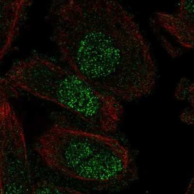 Immunocytochemistry/ Immunofluorescence: SP8 Antibody [NBP2-49109]