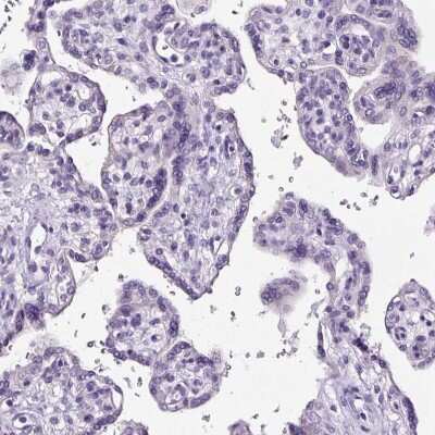Immunohistochemistry-Paraffin: SP8 Antibody [NBP2-49109]