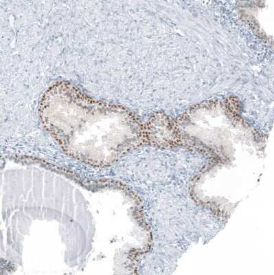 Immunohistochemistry-Paraffin: SP8 Antibody [NBP2-49109]