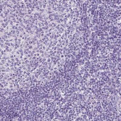 Immunohistochemistry-Paraffin: SP8 Antibody [NBP2-49109]