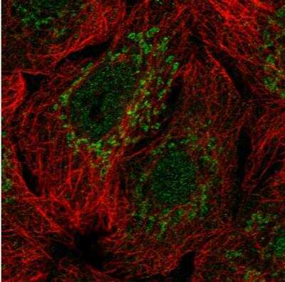 Immunocytochemistry/ Immunofluorescence: SP9 Antibody [NBP2-38967]