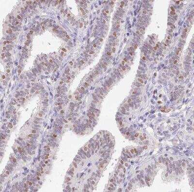 Immunohistochemistry-Paraffin: SP9 Antibody [NBP2-38967]