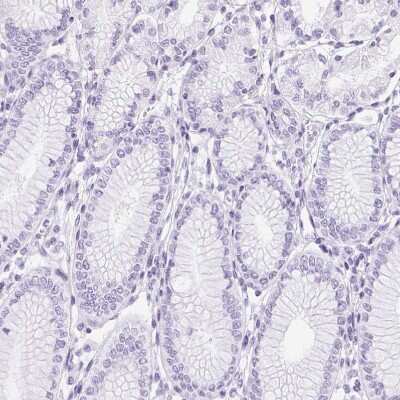Immunohistochemistry-Paraffin: SP9 Antibody [NBP2-38967]