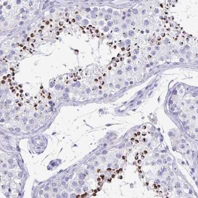 Immunohistochemistry: SPACA1 Antibody [NBP2-38506]