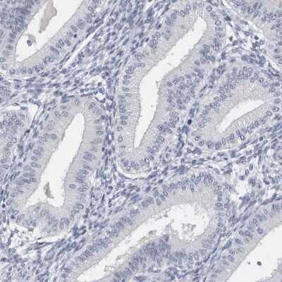 Immunohistochemistry-Paraffin: SPACA1 Antibody [NBP1-80792]