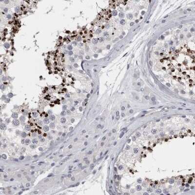 Immunohistochemistry-Paraffin: SPACA1 Antibody [NBP1-80792]