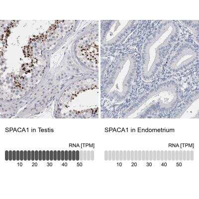 Immunohistochemistry-Paraffin: SPACA1 Antibody [NBP1-80792]