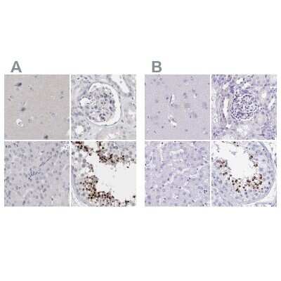 Immunohistochemistry-Paraffin: SPACA1 Antibody [NBP1-80792]