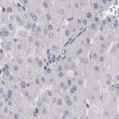 Immunohistochemistry-Paraffin: SPACA1 Antibody [NBP1-80792]