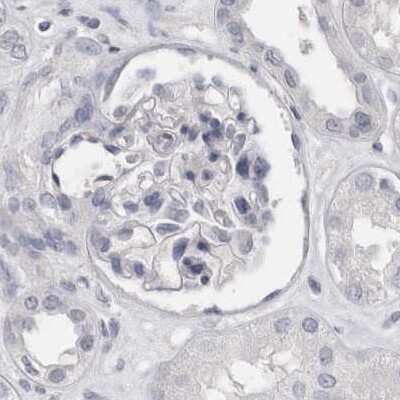 Immunohistochemistry-Paraffin: SPACA1 Antibody [NBP1-80792]