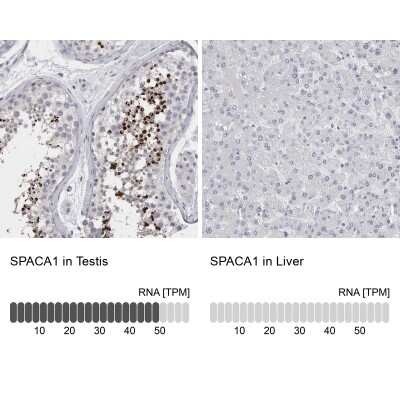 Immunohistochemistry-Paraffin: SPACA1 Antibody [NBP1-80792]