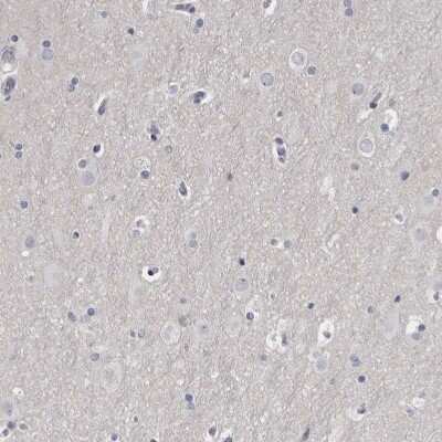 Immunohistochemistry-Paraffin: SPACA1 Antibody [NBP1-80792]