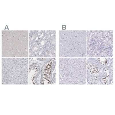 Immunohistochemistry-Paraffin: SPACA1 Antibody [NBP1-80792]