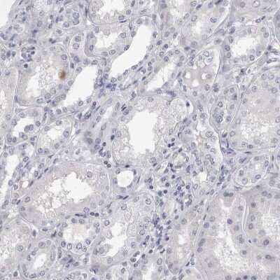 Immunohistochemistry-Paraffin: SPACA1 Antibody [NBP1-80792]