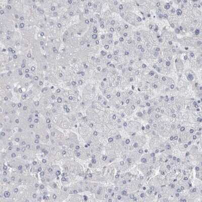 Immunohistochemistry-Paraffin: SPACA1 Antibody [NBP1-80792]