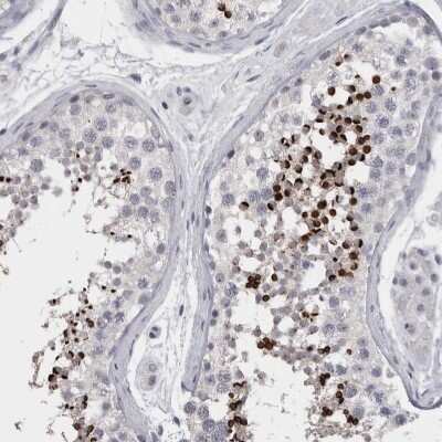 Immunohistochemistry-Paraffin: SPACA1 Antibody [NBP1-80792]