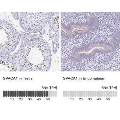 Immunohistochemistry-Paraffin: SPACA1 Antibody [NBP2-38506]