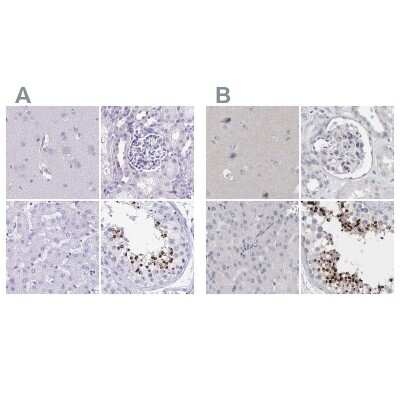 Immunohistochemistry-Paraffin: SPACA1 Antibody [NBP2-38506]