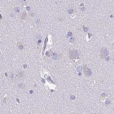 Immunohistochemistry-Paraffin: SPACA1 Antibody [NBP2-38506]