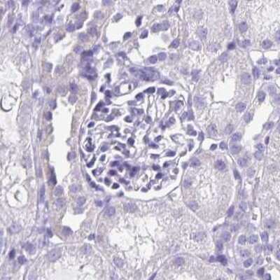 Immunohistochemistry-Paraffin: SPACA1 Antibody [NBP2-38506]