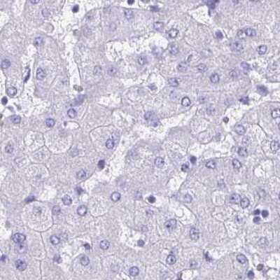 Immunohistochemistry-Paraffin: SPACA1 Antibody [NBP2-38506]