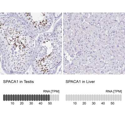 Immunohistochemistry-Paraffin: SPACA1 Antibody [NBP2-38506]