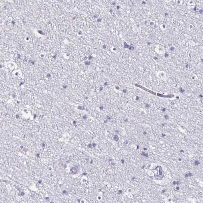 Immunohistochemistry-Paraffin: SPACA1 Antibody [NBP2-38506]