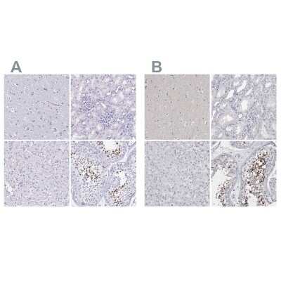 Immunohistochemistry-Paraffin: SPACA1 Antibody [NBP2-38506]
