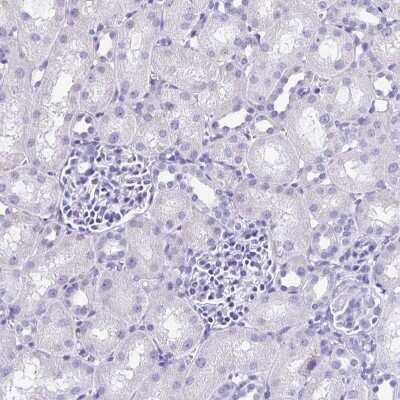 Immunohistochemistry-Paraffin: SPACA1 Antibody [NBP2-38506]