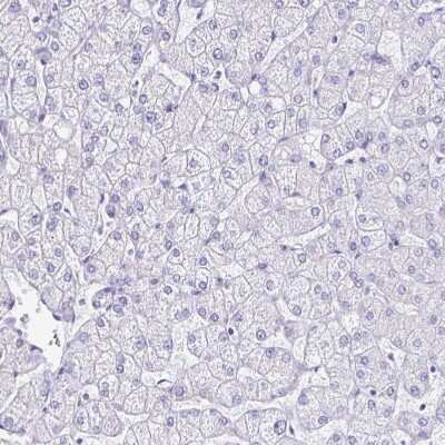 Immunohistochemistry-Paraffin: SPACA1 Antibody [NBP2-38506]