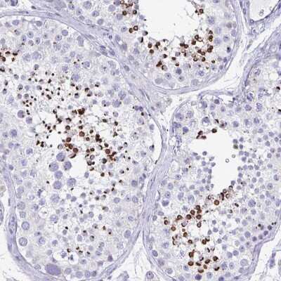Immunohistochemistry-Paraffin: SPACA1 Antibody [NBP2-38506]
