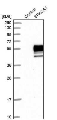 Western Blot: SPACA1 Antibody [NBP1-80792]