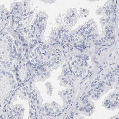 Immunohistochemistry: SPACA3 Antibody [NBP1-89136]