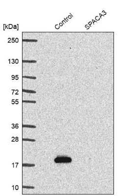 Western Blot: SPACA3 Antibody [NBP1-89136]