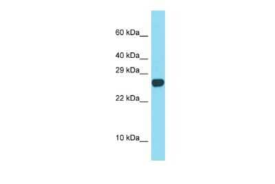 Western Blot: SPACA3 Antibody [NBP2-83578]