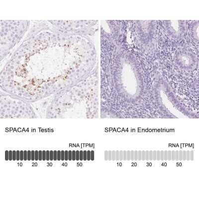 Immunohistochemistry-Paraffin: SPACA4 Antibody [NBP1-80793]