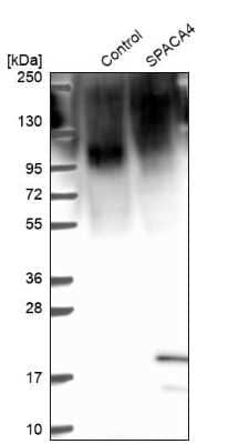 Western Blot: SPACA4 Antibody [NBP2-38913]