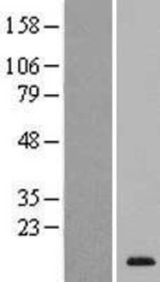 Western Blot: SPACA4 Overexpression Lysate [NBL1-16363]