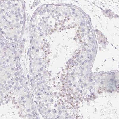 Immunohistochemistry: SPACA5B Antibody [NBP2-46703]