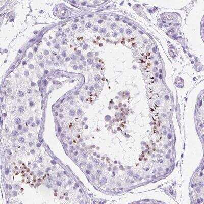 Immunohistochemistry: SPACA5 Antibody [NBP2-46744]