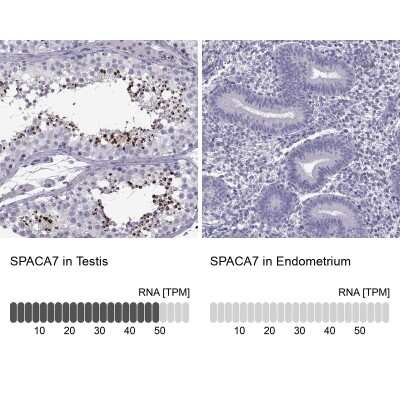 Immunohistochemistry-Paraffin: SPACA7 Antibody [NBP2-62618]