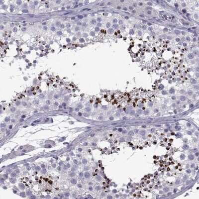 Immunohistochemistry-Paraffin: SPACA7 Antibody [NBP2-62618]