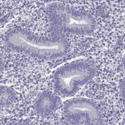 Immunohistochemistry-Paraffin: SPACA7 Antibody [NBP2-62618]
