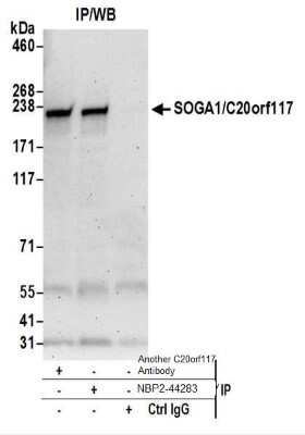 Immunoprecipitation: SPACA9 Antibody [NBP2-44283]