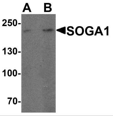 Western Blot: SPACA9 AntibodyBSA Free [NBP2-82011]