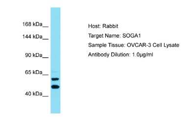 Western Blot: SPACA9 Antibody [NBP2-85793]