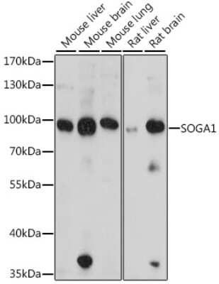 Western Blot: SPACA9 AntibodyAzide and BSA Free [NBP2-94689]